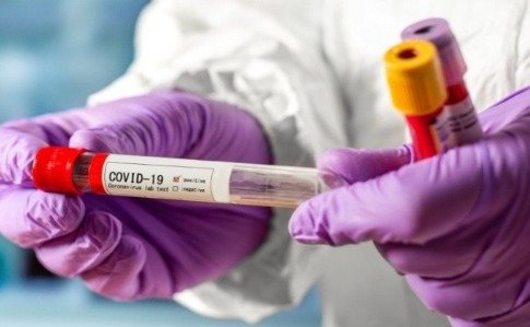 Коронавирусом уже переболели более 1,2 млн украинцев