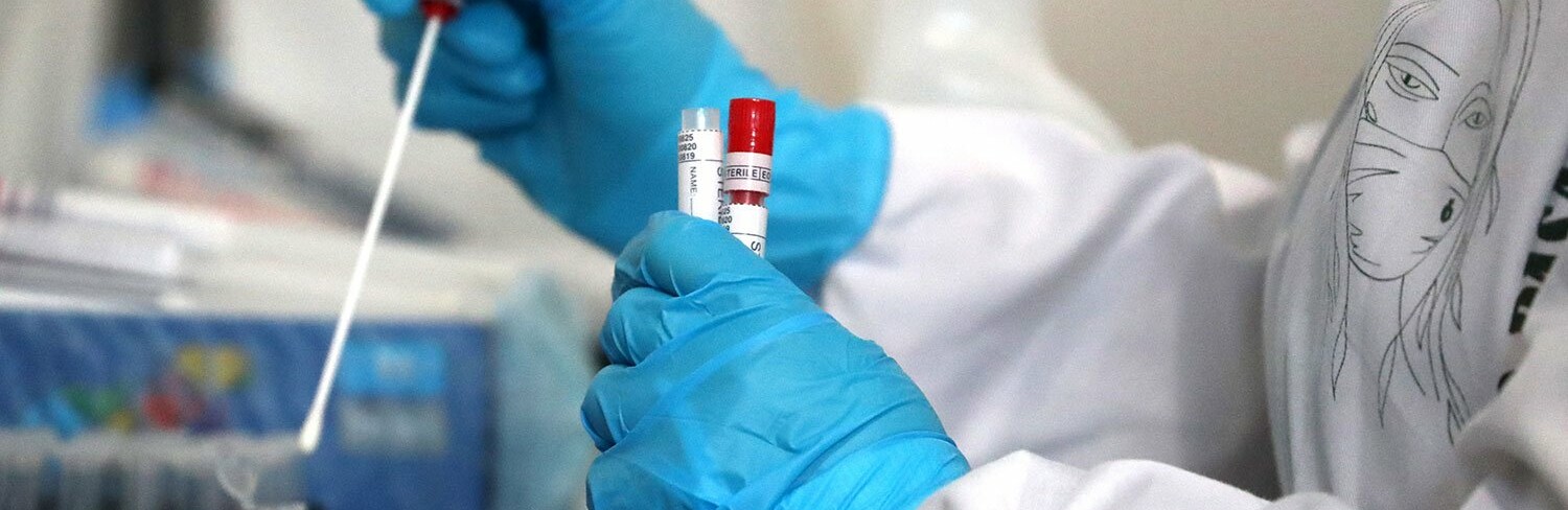 Минимум с начала года. В Украине 535 новых COVID-случаев