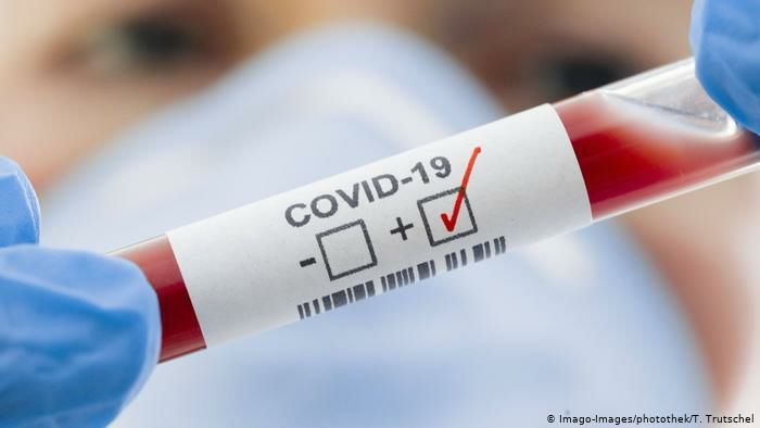 В Украине за прошлые сутки зафиксированы 420 новых случаев COVID-19