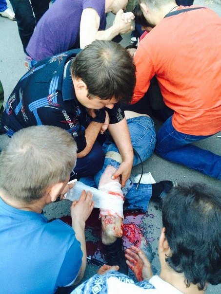 Двое жителей Красноармейска получили смертельные ранения в результате стрельбы, открытой бойцами батальона «Днепр» (Обновлено) (фото) - фото 3